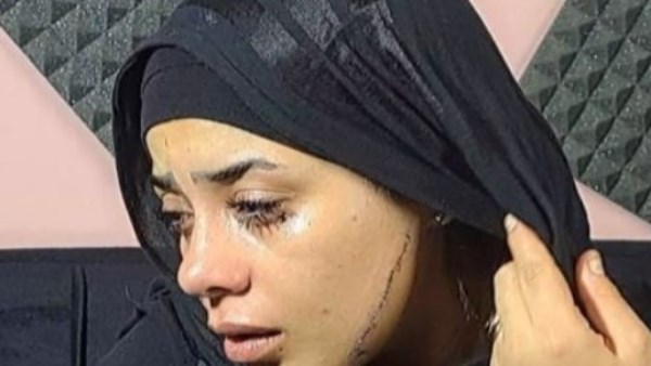 إحالة المتهمة بتشويه وجه عروس مصر القديمة إلى المحاكمة الجنائية