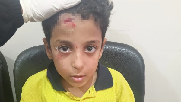 موظف يتهم مدرسة في زهراء أكتوبر بالإهمال بعد تعرض ابنه لواقعة خطيرة