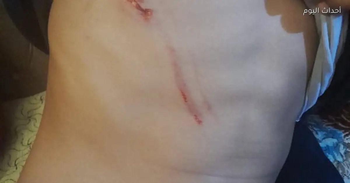 عقر جديد للكلاب الضالة يثير مخاوف أهالي السويس