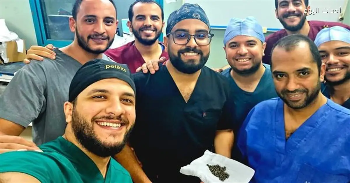 نقابة أطباء قنا تحتفل بنجاح إزالة 58 حصوة من كلى مريض بمستشفى قنا الجامعي