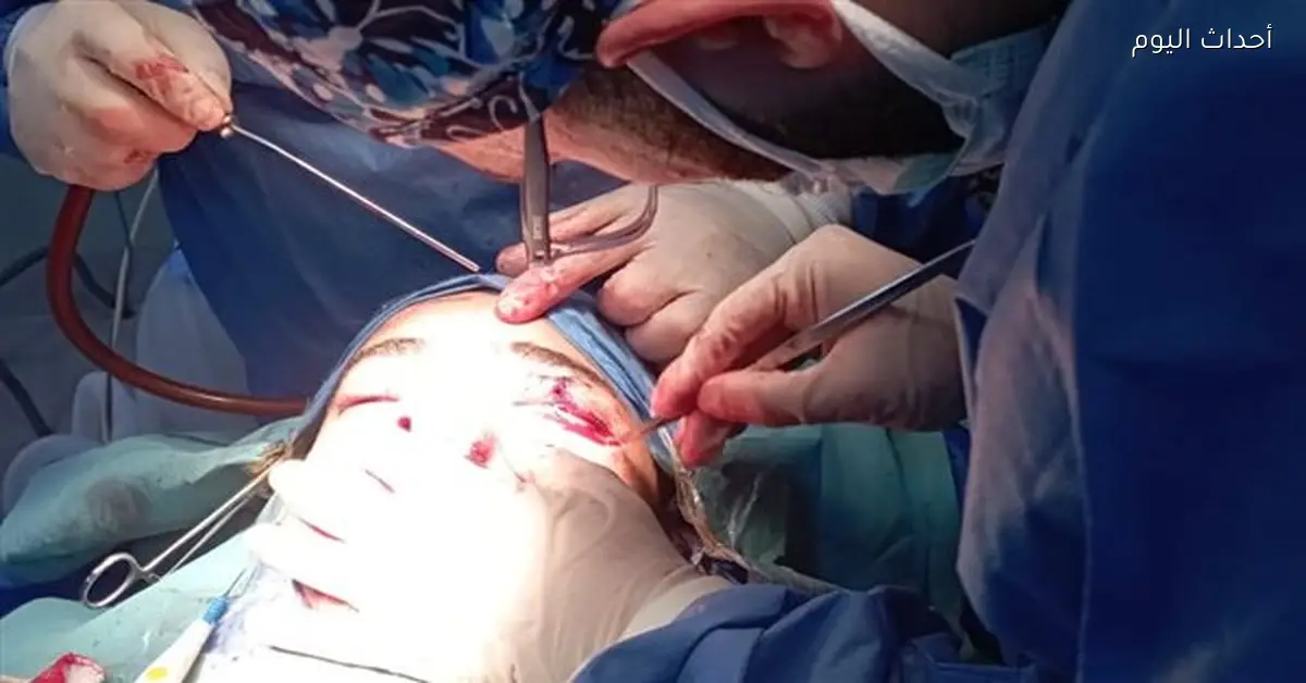 إنقاذ شاب مصاب بإصابات خطيرة في الرأس والوجه بمستشفى تمي الأمديد