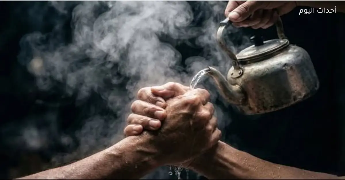 السوشيال ميديا ترفض تريند حرق الأيدي بالشاي المغلي