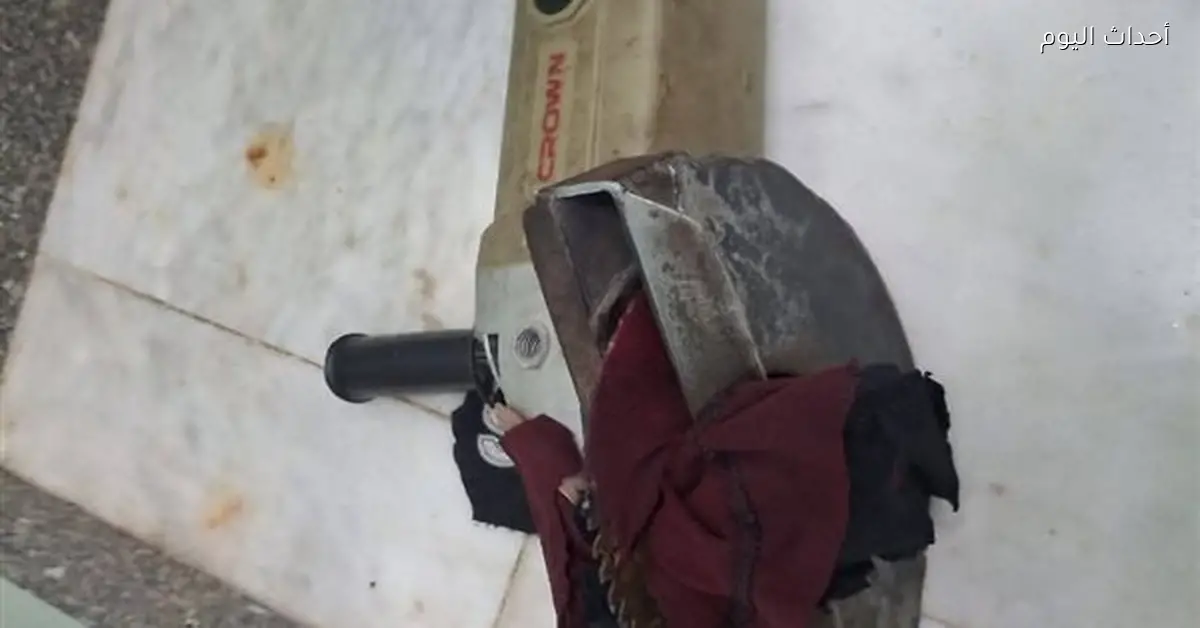 جراحة ناجحة لاستخراج منشار كهربائي من بطن طفل بدمياط