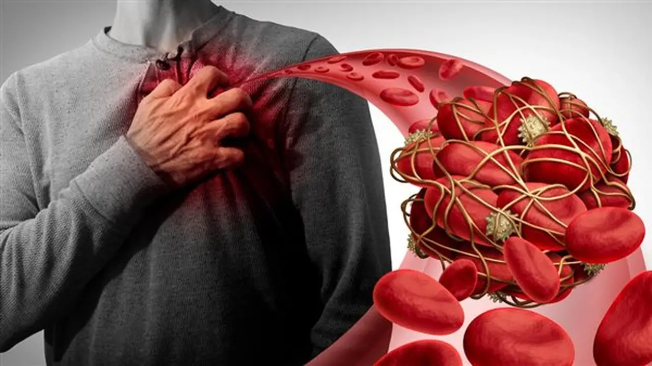 أعراض انسداد شرايين القلب وسبل التعامل معها
